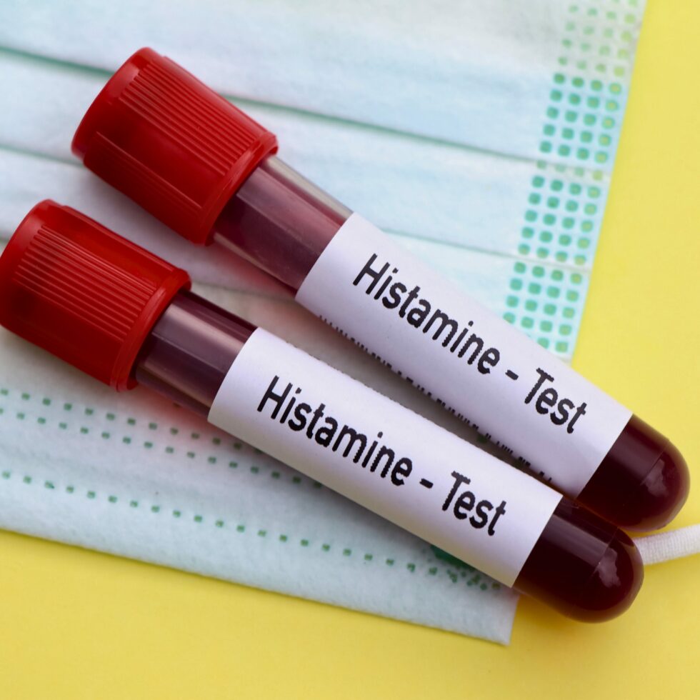 Histamin-Intoleranz-Symptome entschlüsselt: Der umfassende Leitfaden